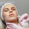Top 5 cele mai populare interventii estetice non-chirurgicale