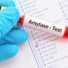 adv-test-amilaza